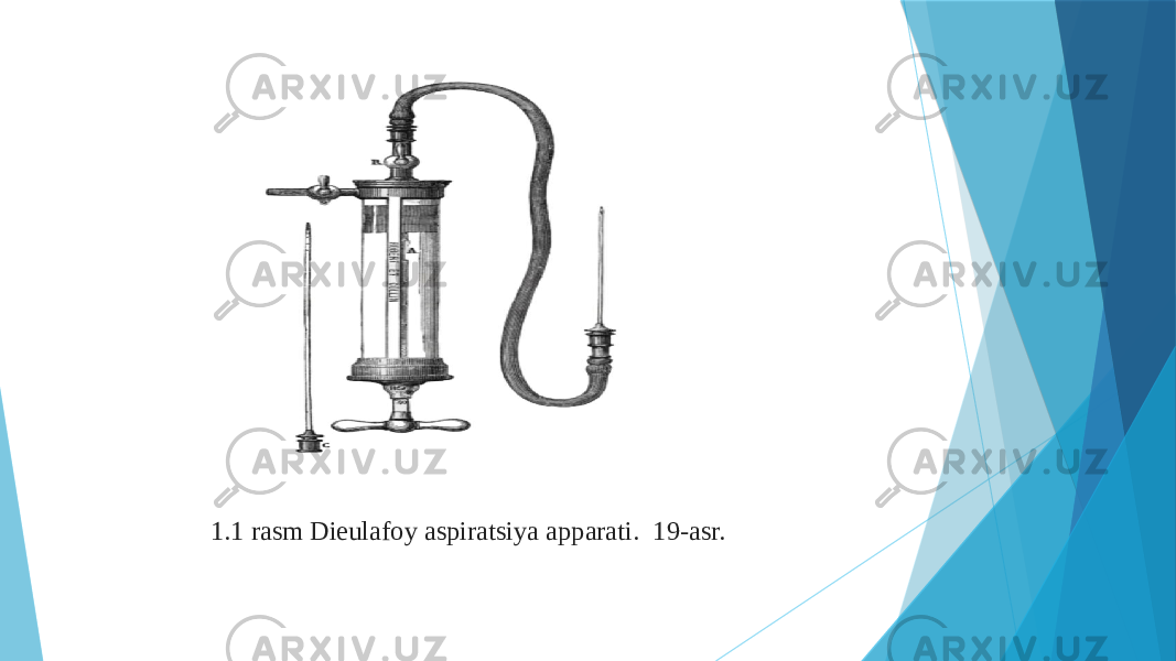 1.1 rasm Dieulafoy aspiratsiya apparati. 19-asr. 