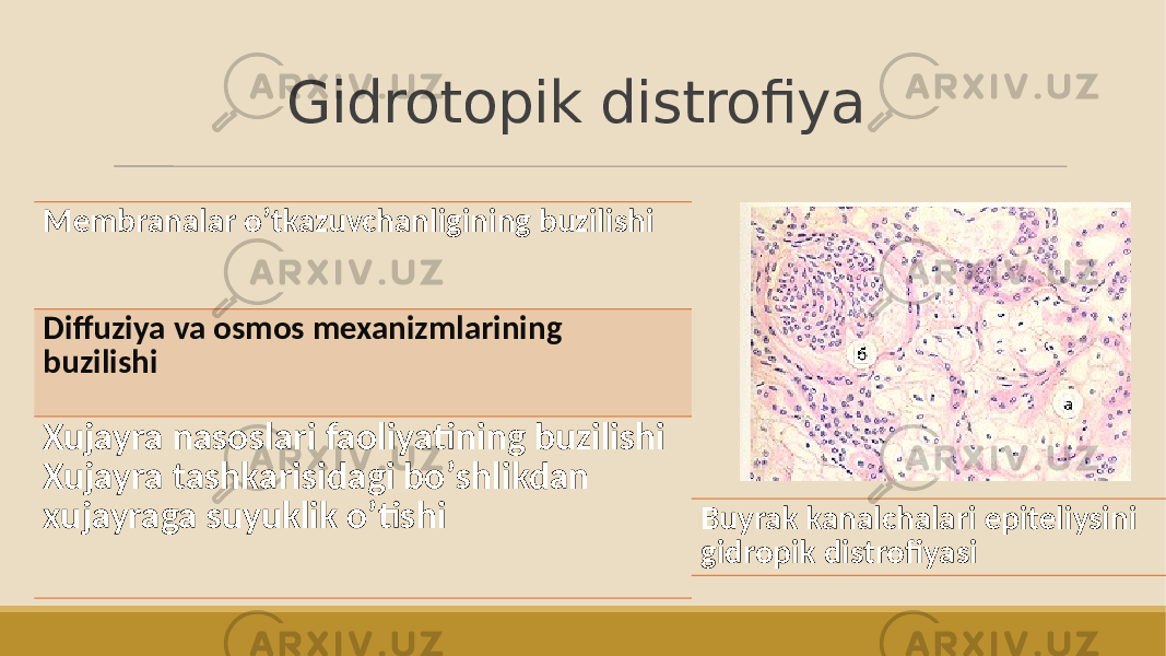 Gidrotopik distrofiya Membranalar oʼtkazuvchanligining buzilishi Diffuziya va osmos mexanizmlarining buzilishi Xujayra nasoslari faoliyatining buzilishi Xujayra tashkarisidagi boʼshlikdan xujayraga suyuklik oʼtishi Buyrak kanalchalari epiteliysini gidropik distrofiyasi 