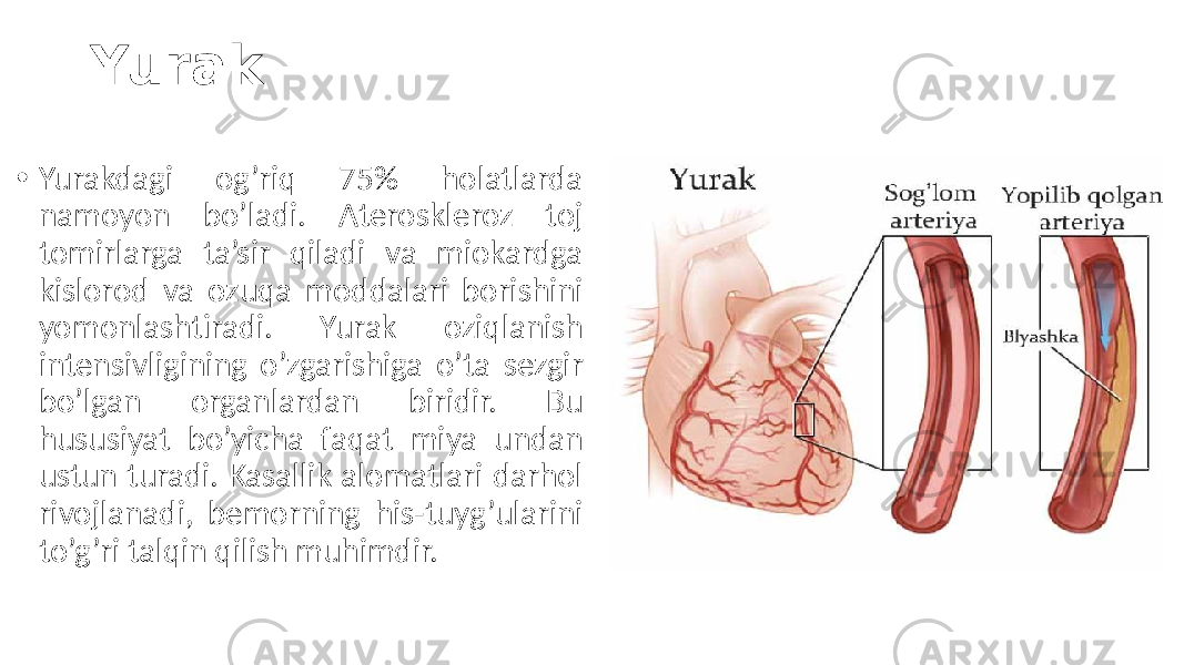 Yurak • Yurakdagi  og’riq   75%   holatlarda   namoyon   bo’ladi.   Ateroskleroz   toj   tomirlarga   ta’sir   qiladi   va   miokardga   kislorod   va   ozuqa   moddalari   borishini   yomonlashtiradi.   Yurak   oziqlanish   intensivligining   o’zgarishiga   o’ta   sezgir   bo’lgan   organlardan   biridir.   Bu   hususiyat   bo’yicha   faqat   miya   undan   ustun  turadi.  Kasallik  alomatlari  darhol   rivojlanadi,   bemorning   his-tuyg’ularini   to’g’ri  talqin  qilish  muhimdir. 