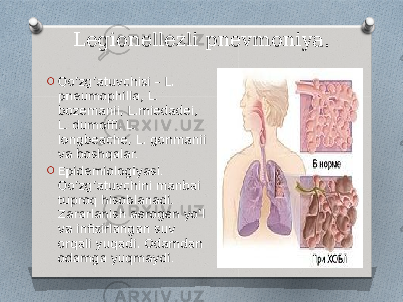 Legionellezli pnevmoniya. O Qo’zg’atuvchisi – L. pneumophilla, L. bozemanii, L.miedadei, L. dumoffi. L. longbeache, L. gonmanii va boshqalar. O Epidemiologiyasi. Qo’zg’atuvchini manbai tuproq hisoblanadi. Zararlanish aerogen yo’l va infisirlangan suv orqali yuqadi. Odamdan odamga yuqmaydi. 