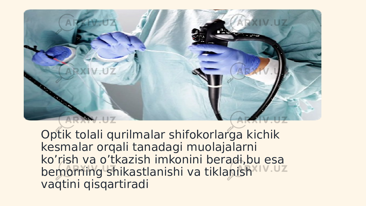 Optik tolali qurilmalar shifokorlarga kichik kesmalar orqali tanadagi muolajalarni ko’rish va o’tkazish imkonini beradi,bu esa bemorning shikastlanishi va tiklanish vaqtini qisqartiradi 