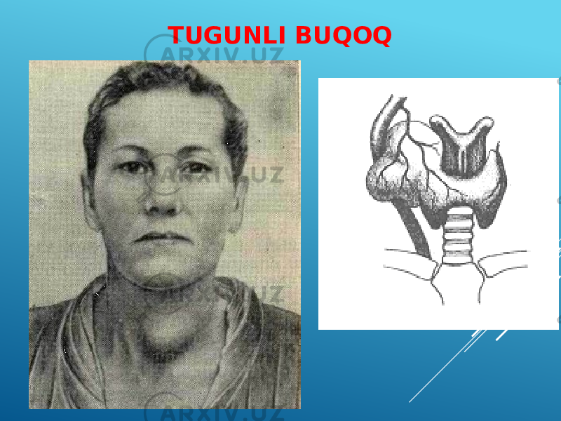 TUGUNLI BUQOQ 