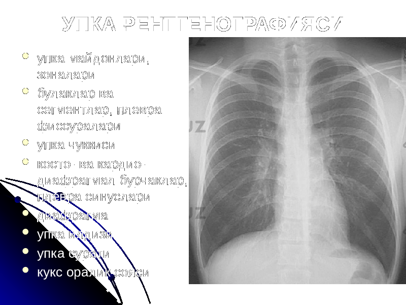 УПКА РЕНТГЕНОГРАФИЯСИ  упка майдонлари, зоналари  булаклар ва сегментлар, плевра фиссуралари  упка чуккиси  косто- ва кардио- диафрагмал бурчаклар, плевра синуслари  диафрагма  упка илдизи  упка сурати  кукс оралик сояси 