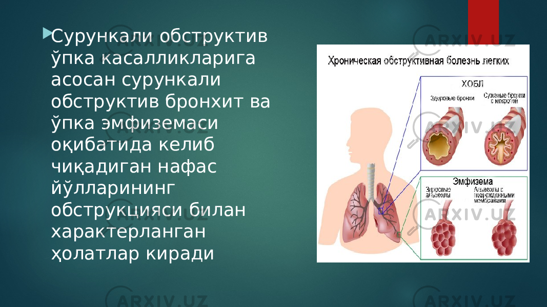  Сурункали обструктив ўпка касалликларига асосан сурункали обструктив бронхит ва ўпка эмфиземаси оқибатида келиб чиқадиган нафас йўлларининг обструкцияси билан характерланган ҳолатлар киради 