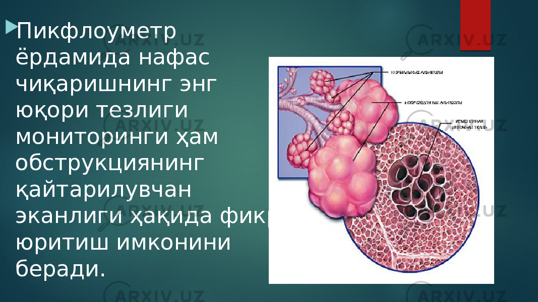  Пикфлоуметр ёрдамида нафас чиқаришнинг энг юқори тезлиги мониторинги ҳам обструкциянинг қайтарилувчан эканлиги ҳақида фикр юритиш имконини беради. 