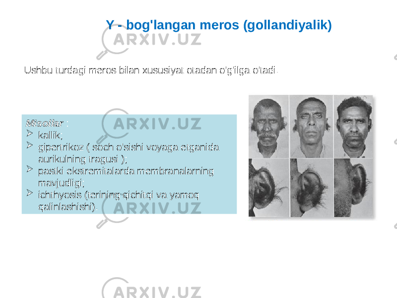 Y - bog&#39;langan meros (gollandiyalik) Ushbu turdagi meros bilan xususiyat otadan o&#39;g&#39;ilga o&#39;tadi. Misollar :  kallik;  gipertrikoz ( soch o&#39;sishi voyaga etganida aurikulning tragusi );  pastki ekstremitalarda membranalarning mavjudligi;  ichthyosis (terining qichitqi va yamoq qalinlashishi). 