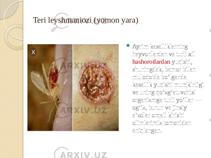 Teri leyshmaniozi (yomon yara)    Ayrim kasalliklarning hayvonlardan va turli xil hashorotlardan yuqishi, shuningdek, bemor bilan muloqotda boʻlganda kasallik yuqishi mumkinligi va uning qoʻzgʻatuvchisi organizmga turli yoʻllar — ogʻiz, burun va jinsiy aʼzolar orqali kirishi olimlarimiz tomonidan aniqlangan. 