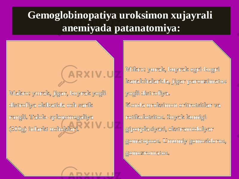 Gemoglobinopatiya uroksimon xujayrali anemiyada patanatomiya: Makro: yurak, jigar, buyrak yogli distrofiya okibatida och sarik rangli. Talok- splenomegaliya (500g) infarkt uchoklari. Mikro: yurak, buyrak egri-bugri kanalchalarida, jigar parenximatoz yogli distrofiya. Konda uroksimon eritrotsitlar va retikulotsitoz. Suyak kumigi giperplaziyasi, ekstramedulyar gematopoez. Umumiy gemosideroz, gemoxromatoz. 