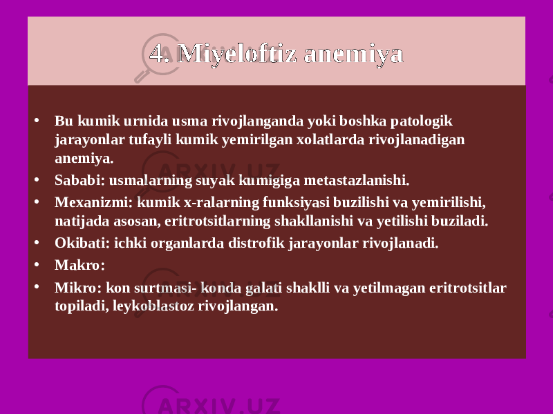 4. Miyeloftiz anemiya • Bu kumik urnida usma rivojlanganda yoki boshka patologik jarayonlar tufayli kumik yemirilgan xolatlarda rivojlanadigan anemiya. • Sababi: usmalarning suyak kumigiga metastazlanishi. • Mexanizmi: kumik x-ralarning funksiyasi buzilishi va yemirilishi, natijada asosan, eritrotsitlarning shakllanishi va yetilishi buziladi. • Okibati: ichki organlarda distrofik jarayonlar rivojlanadi. • Makro: • Mikro: kon surtmasi- konda galati shaklli va yetilmagan eritrotsitlar topiladi, leykoblastoz rivojlangan. 