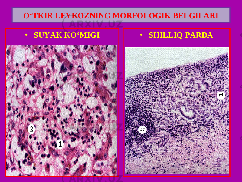 • SUYAK KO‘MIGI • SHILLIQ PARDAO‘TKIR LEYKOZNING MORFOLOGIK BELGILARI 