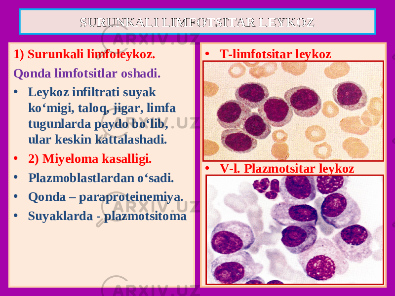 1) Surunkali limfoleykoz. Qonda limfotsitlar oshadi. • Leykoz infiltrati suyak ko‘migi, taloq, jigar, limfa tugunlarda paydo bo‘lib, ular keskin kattalashadi. • 2) Miyeloma kasalligi. • Plazmoblastlardan o‘sadi. • Qonda – paraproteinemiya. • Suyaklarda - plazmotsitoma • T-limfotsitar leykoz • V-l. Plazmotsitar leykozSURUNKALI LIMFOTSITAR LEYKOZ 