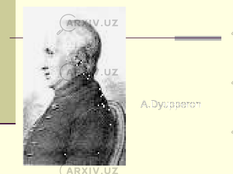 A.Dyupperon 