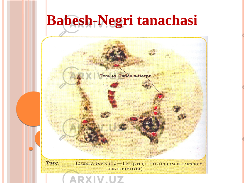 Babesh-Negri tanachasi 