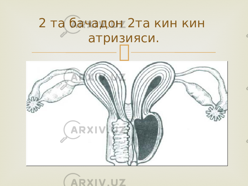 2 та бачадон 2та кин кин атризияси. 