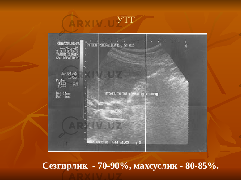 УТТ Сезгирлик - 70-90%, махсуслик - 80-85%. 