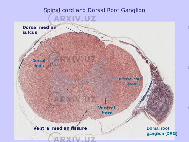 Spinal cord and Dorsal Root Ganglion Ventral horn (Lateral horn) if presentDorsal horn Dorsal root ganglion (DRG)Ventral median fissureDorsal median sulcus 