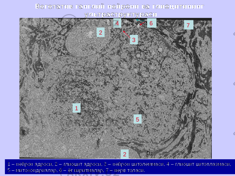 Вегетатив ганглий нейрони ва глиоцитининг ультраструктураси 1 2 34 5 2 6 7 1 – нейрон ядроси, 2 – глиоцит ядроси, 3 – нейрон цитолеммаси, 4 – глиоцит цитоплазмаси, 5 – митохондриялар, 6 – ёғ киритмалар, 7 – нерв толаси. 