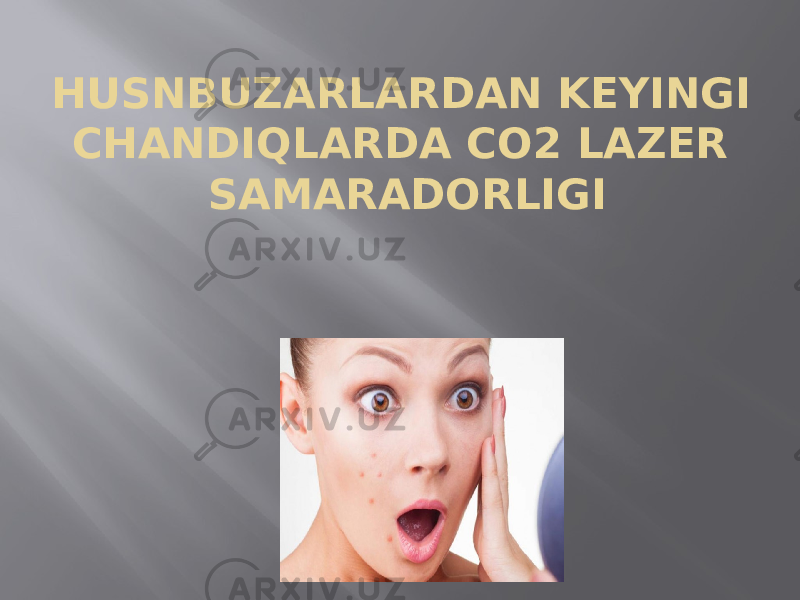 HUSNBUZARLARDAN KEYINGI CHANDIQLARDA CO2 LAZER SAMARADORLIGI 