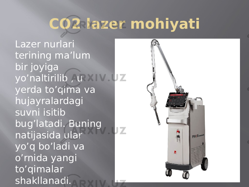 CO2 lazer mohiyati Lazer nurlari terining ma’lum bir joyiga yo’naltirilib , u yerda to’qima va hujayralardagi suvni isitib bug’latadi. Buning natijasida ular yo’q bo’ladi va o’rnida yangi to’qimalar shakllanadi. 