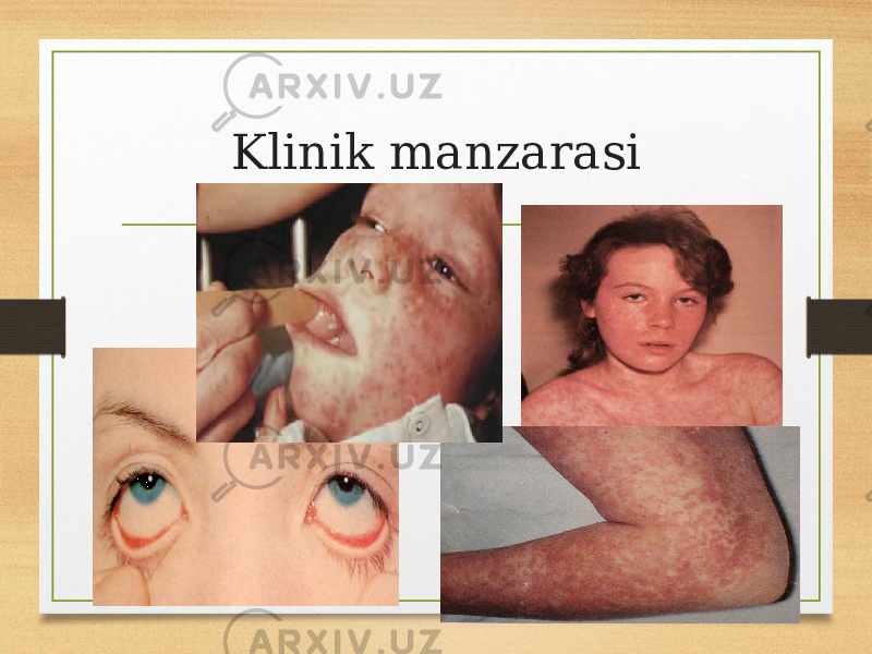 Klinik manzarasi 