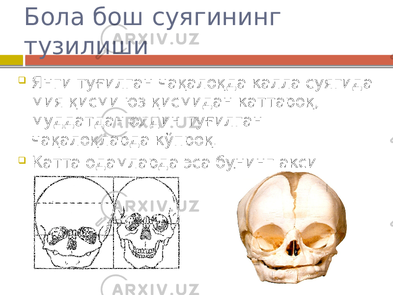 Бола бош суягининг тузилиши  Янги туғилган чақалоқда калла суягида мия қисми юз қисмидан каттароқ, муддатдан олдин туғилган чақалоқларда кўпроқ.  Катта одамларда эса бунинг акси 