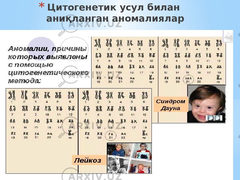 * Цитогенетик усул билан аниқланган аномалиялар 