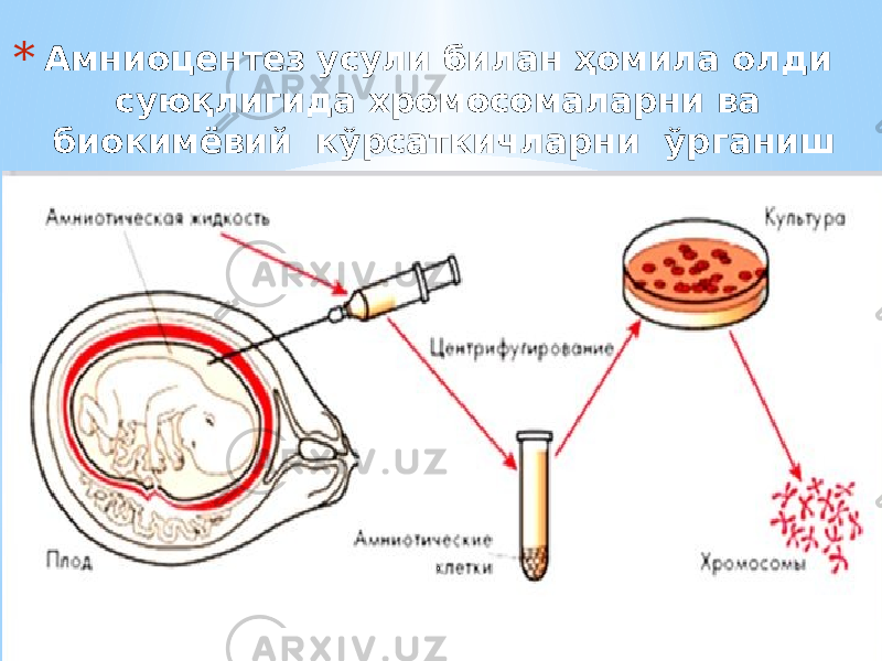 * Амниоцентез усули билан ҳомила олди суюқлигида хромосомаларни ва биокимёвий кўрсаткичларни ўрганиш 