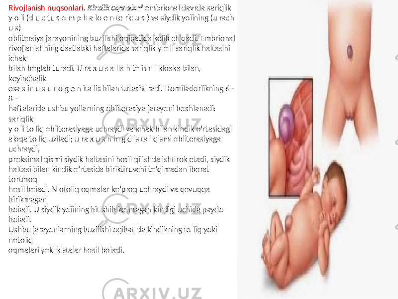 Rivojlanish nuqsonlari . Kindik oqmalari embrional davrda sariqlik y o li (d u c tu s o m p h a lo e n te ric u s ) va siydik yoiining (u rach u s) oblitersiya jarayonining buzilishi oqibatida kelib chiqadi. Embrional rivojlanishning dastlabki haftalarida sariqlik y o li sariqlik haltasini ichak bilan boglab turadi. U ra x u s a lla n to is n i kloaka bilan, keyinchalik esa s in u s u r o g e n ita lis bilan tutashtiradi. Homiladorlikning 6 - 8 - haftalarida ushbu yollarning obliterasiya jarayoni boshlanadi: sariqlik y o li to liq obliterasiyaga uchraydi va ichak bilan kindik o‘rtasidagi aloqa to liq uziladi; u ra x u s n in g d is ta l qismi obliterasiyaga uchraydi, proksimal qismi siydik haltasini hosil qilishda ishtirok etadi, siydik haltasi bilan kindik o‘rtasida biriktiruvchi to‘qimadan iborat tortmoq hosil boiadi. N otoliq oqmalar ko‘proq uchraydi va qovuqqa birikmagan boiadi. U siydik yoiining bitishib ketmagan kindigi uchida paydo boiadi. Ushbu jarayonlarning buzilishi oqibatida kindikning to liq yoki notoliq oqmalari yoki kistalar hosil boiadi. 