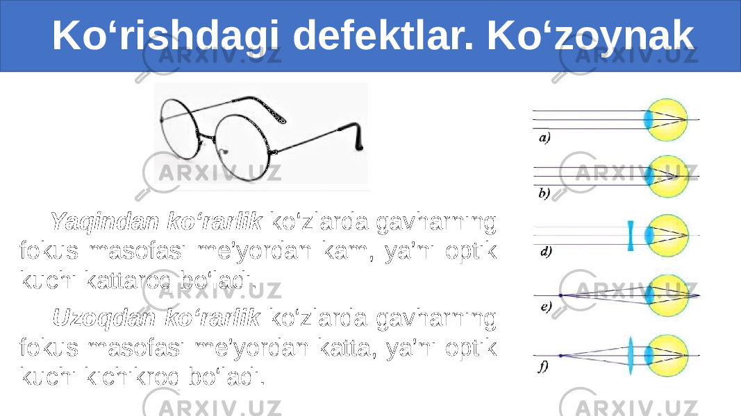  Ko‘rishdagi defektlar. Ko‘zoynak Yaqindan ko‘rarlik ko‘zlarda gavharning fokus masofasi me’yordan kam, ya’ni optik kuchi kattaroq bo‘ladi. Uzoqdan ko‘rarlik ko‘zlarda gavharning fokus masofasi me’yordan katta, ya’ni optik kuchi kichikroq bo‘ladi. 