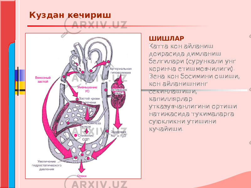 ШИШЛАР Катта кон айланиш доирасида димланиш белгилари (сурункали унг коринча етишмовчилиги). Вена кон босимини ошиши, кон айланишнинг секинлашиши, капиллярлар утказувчанлигини ортиши натижасида тукималарга суюкликни утишини кучайиши. Куздан кечириш 