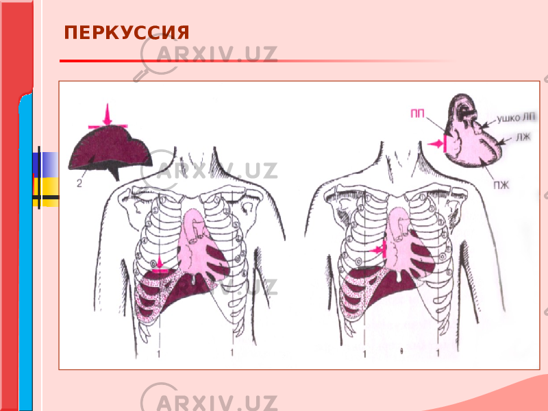 ПЕРКУССИЯ 