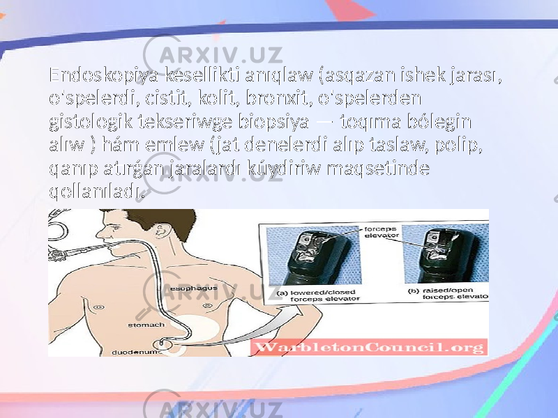 Endoskopiya kesellikti anıqlaw (asqazan ishek jarası, o&#39;spelerdi, cistit, kolit, bronxit, o&#39;spelerden gistologik tekseriwge biopsiya — toqıma bólegin alıw ) hám emlew (jat denelerdi alıp taslaw, polip, qanıp atırǵan jaralardı kúydiriw maqsetinde qollanıladı. 