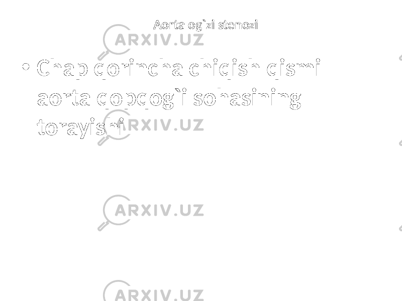 Aorta og`zi stenozi • Chap qorincha chiqish qismi aorta qopqog`i sohasining torayishi 