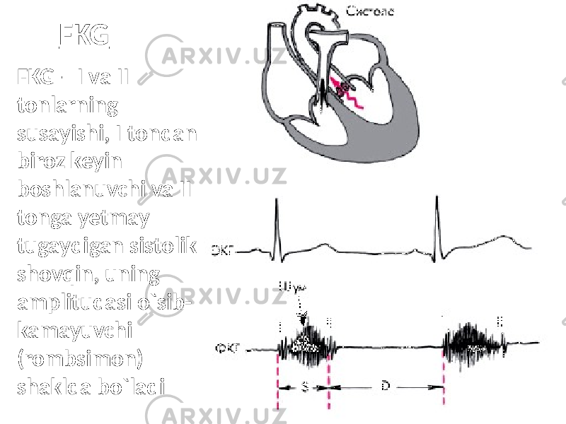 FKG FKG – I va II tonlarning susayishi, I tondan biroz keyin boshlanuvchi va II tonga yetmay tugaydigan sistolik shovqin, uning amplitudasi o`sib- kamayuvchi (rombsimon) shaklda bo`ladi 