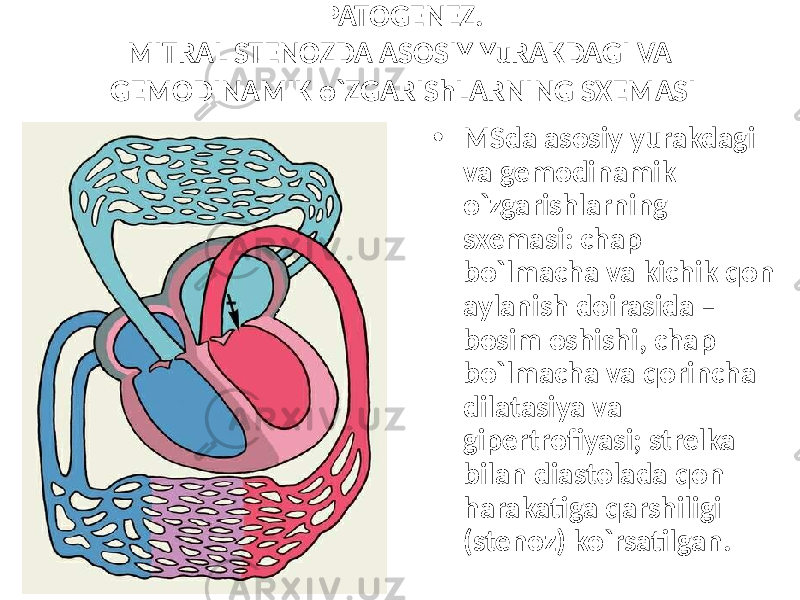 PATOGENEZ. MITRAL STENOZDA ASOSIY YuRAKDAGI VA GEMODINAMIK o`ZGARIShLARNING SXEMASI • MSda asosiy yurakdagi va gemodinamik o`zgarishlarning sxemasi: chap bo`lmacha va kichik qon aylanish doirasida – bosim oshishi, chap bo`lmacha va qorincha dilatasiya va gipertrofiyasi; strelka bilan diastolada qon harakatiga qarshiligi (stenoz) ko`rsatilgan. 