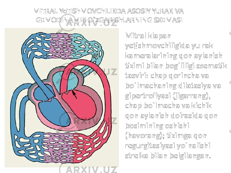 MITRAL YeTIShMOVChILIKDA ASOSIY YuRAK VA GEMODINAMIK O`ZGARIShLARNING SXEMASI • Mitral klapan yetishmovchiligida yu-rak kameralarining qon aylanish tizimi bilan bog`liligi sxematik tasviri: chap qorincha va bo`lmachaning dilatasiya va gipertrofiyasi (jigarrang), chap bo`lmacha va kichik qon aylanish doirasida qon bosimining oshishi (havorang); tizimga qon regurgitasiyasi yo`nalishi strelka bilan belgilangan. 