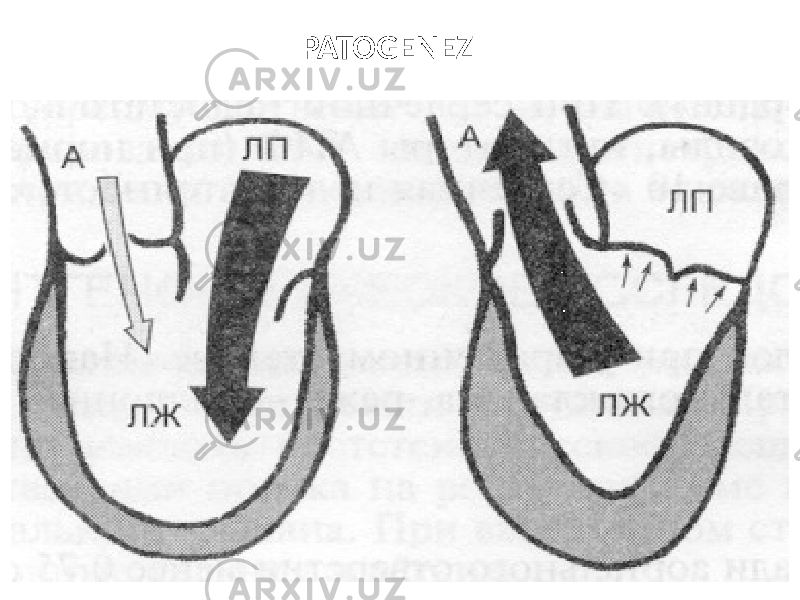 PATOGENEZ 