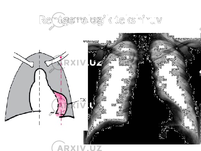 Rentgenologik tekshiruv 