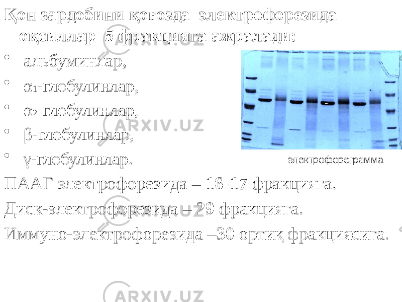 Қон зардобини қоғозда электрофорезида оқсиллар 5 фракцияга ажралади: • альбуминлар, • α 1 -глобулинлар, • α 2 -глобулинлар, • β-глобулинлар, • γ-глобулинлар. ПААГ электрофорезида – 16-17 фракцияга. Диск-электрофорезида – 29 фракцияга. Иммуно-электрофорезида – 30 ортиқ фракциясига. электрофореграмма 