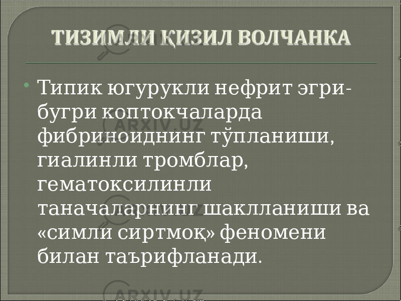  -Типик югурукли нефрит эгри бугри коптокчаларда , фибриноиднинг тўпланиши , гиалинли тромблар гематоксилинли таначаларнинг шаклланиши ва « » симли сиртмоқ феномени . билан таърифланади 