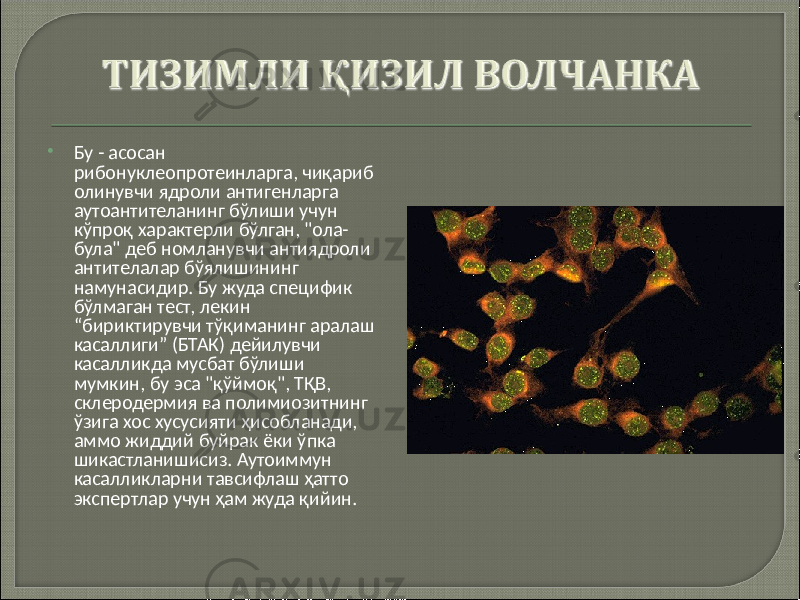  Бу - асосан рибонуклеопротеинларга, чиқариб олинувчи ядроли антигенларга аутоантителанинг бўлиши учун кўпроқ характерли бўлган, &#34;ола- була&#34; деб номланувчи антиядроли антителалар бўялишининг намунасидир. Бу жуда специфик бўлмаган тест, лекин “бириктирувчи тўқиманинг аралаш касаллиги” (БТАК) дейилувчи касалликда мусбат бўлиши мумкин, бу эса &#34;қўймоқ&#34;, ТҚВ, склеродермия ва полимиозитнинг ўзига хос хусусияти ҳисобланади, аммо жиддий буйрак ёки ўпка шикастланишисиз. Аутоиммун касалликларни тавсифлаш ҳатто экспертлар учун ҳам жуда қийин. 