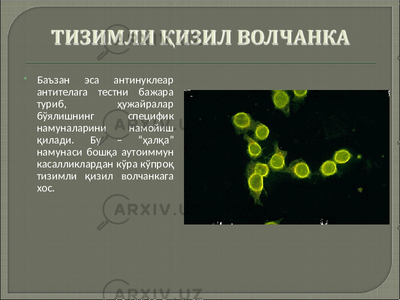  Баъзан эса антинуклеар антителага тестни бажара туриб, ҳужайралар бўялишнинг специфик намуналарини намойиш қилади. Бу – “ҳалқа” намунаси бошқа аутоиммун касалликлардан кўра кўпроқ тизимли қизил волчанкага хос. 