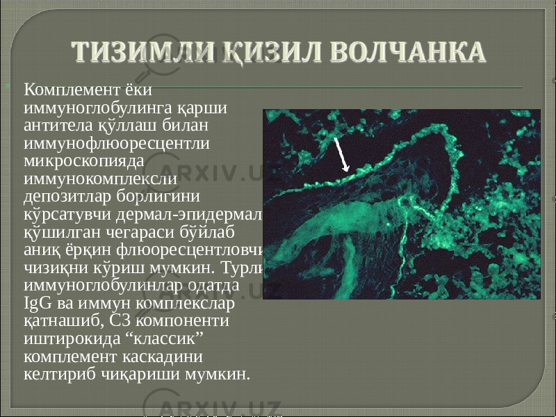  Комплемент ёки иммуноглобулинга қарши антитела қўллаш билан иммунофлюоресцентли микроскопияда иммунокомплексли депозитлар борлигини кўрсатувчи дермал-эпидермал қўшилган чегараси бўйлаб аниқ ёрқин флюоресцентловчи чизиқни кўриш мумкин. Турли иммуноглобулинлар одатда IgG ва иммун комплекслар қатнашиб, С3 компоненти иштирокида “классик” комплемент каскадини келтириб чиқариши мумкин. 