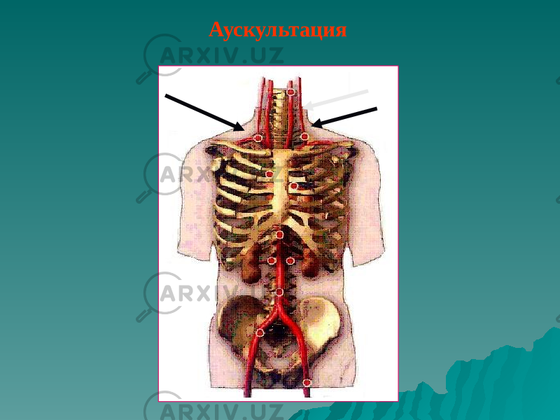 Аускультация 