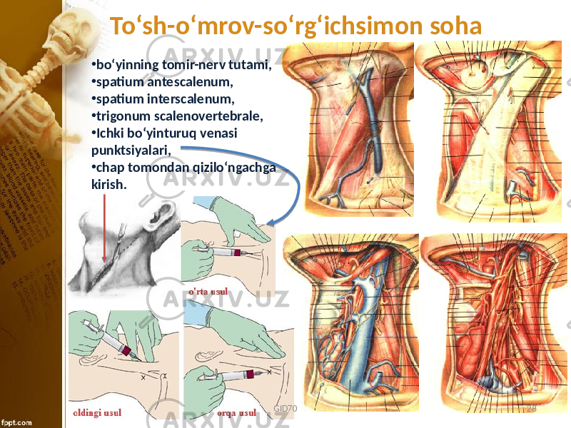 To ʻsh-oʻmrov-soʻrgʻichsimon soha • bo‘yinning tоmir-nеrv tutami, • spatium antescalenum, • spatium interscalenum, • trigonum scalenovertebrale, • Ichki bo‘yinturuq venasi punktsiyalari, • chap tоmоndan qizilo‘ngachga kirish. GID70 28 