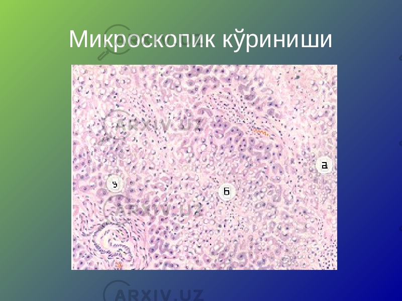 Микроскопик кўриниши 