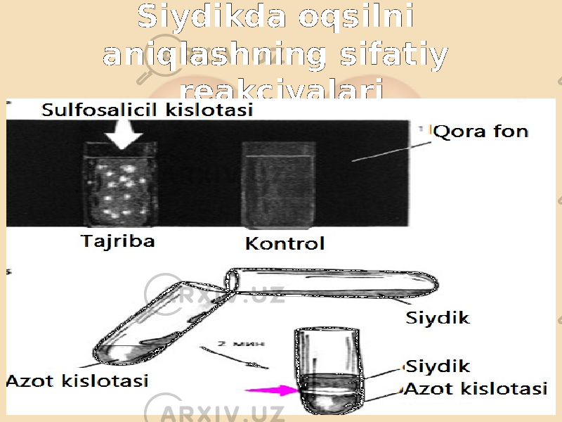 Siydikda oqsilni aniqlashning sifatiy reakciyalari 