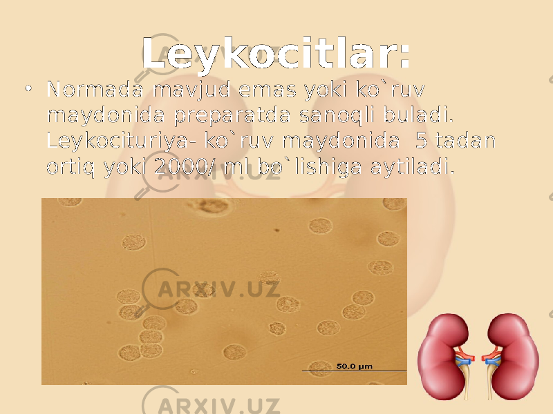 Leykocitlar: • Normada mavjud emas yoki ko`ruv maydonida preparatda sanoqli buladi. Leykocituriya- ko`ruv maydonida 5 tadan ortiq yoki 2000/ ml bo`lishiga aytiladi. 