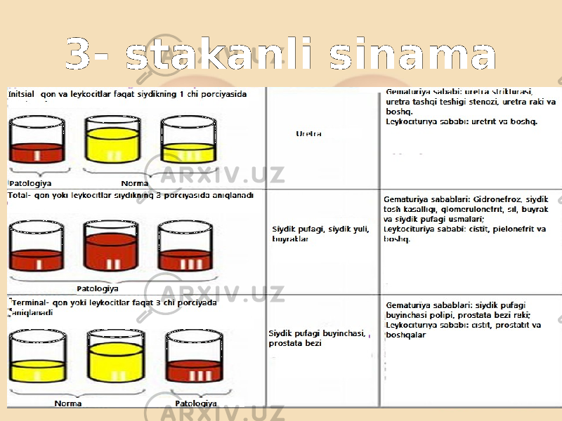 3- stakanli sinama 