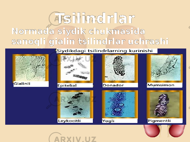 Tsilindrlar Normada siydik chukmasida sanoqli gialin tsilindrlar uchrashi mumkin. 